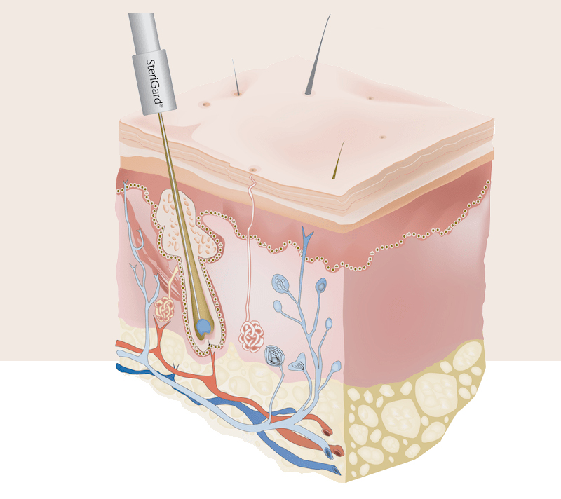 Médecine Esthétique